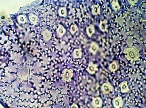 Fossil Metrosideros cuticle from the Miocene Gore Lignite Measures, New Zealand.